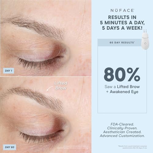 NuFACE Effective Lip Eye Attachment