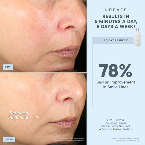 NuFACE Effective Lip Eye Attachment